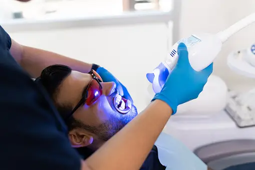 The Ultimate Guide to Laser Teeth Whitening: What You Need to Know